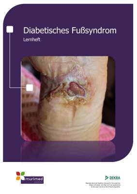 Neu FK 122 Diabetisches Fußsyndrom